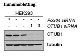 OTUB1